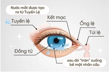 Giải ngố đeo Lens: Đeo kính áp tròng có khóc được không?